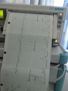 Heartbeat and Contractions